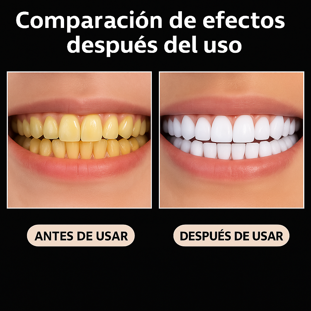 Smile Professional Whitening Kit