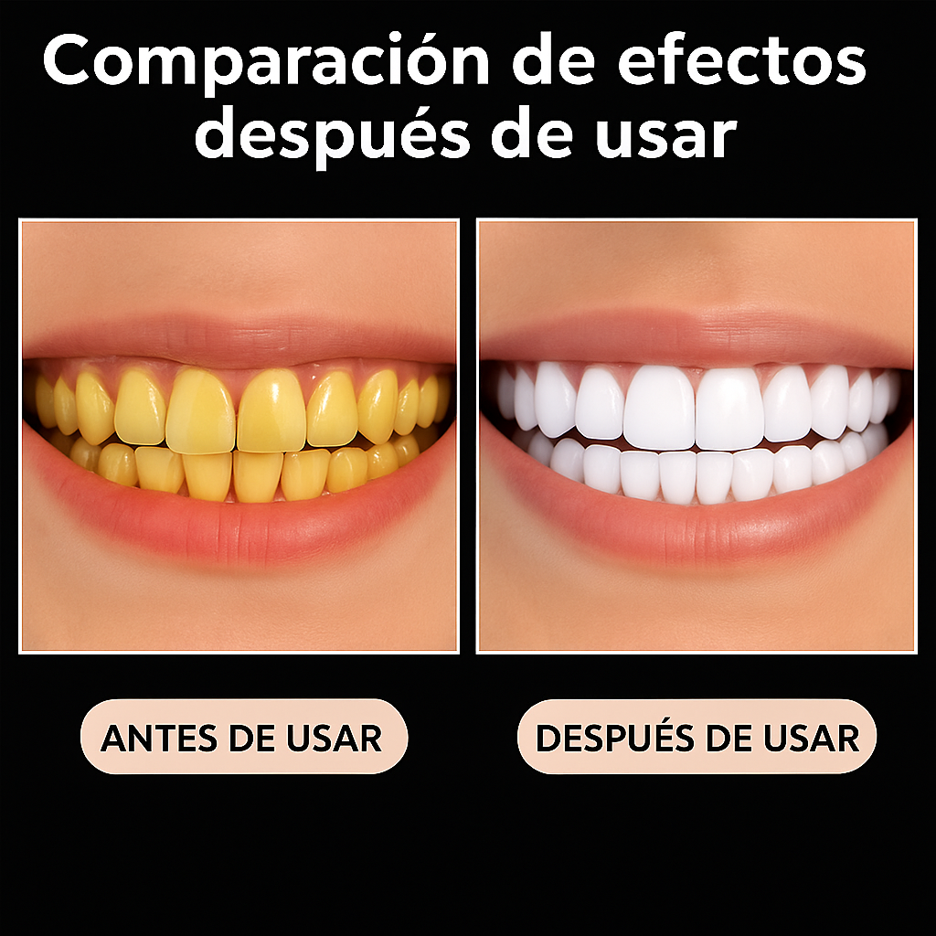 Smile Professional Whitening Kit