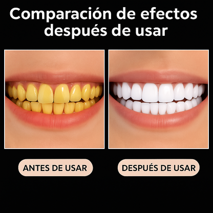 Smile Professional Whitening Kit
